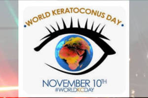 Keratoconus