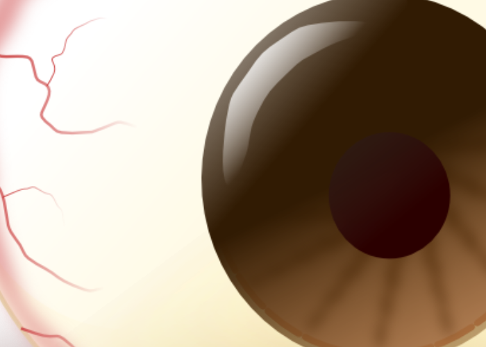 Eye Emergencies