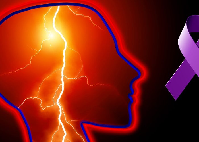 Photosensitive Epilepsy